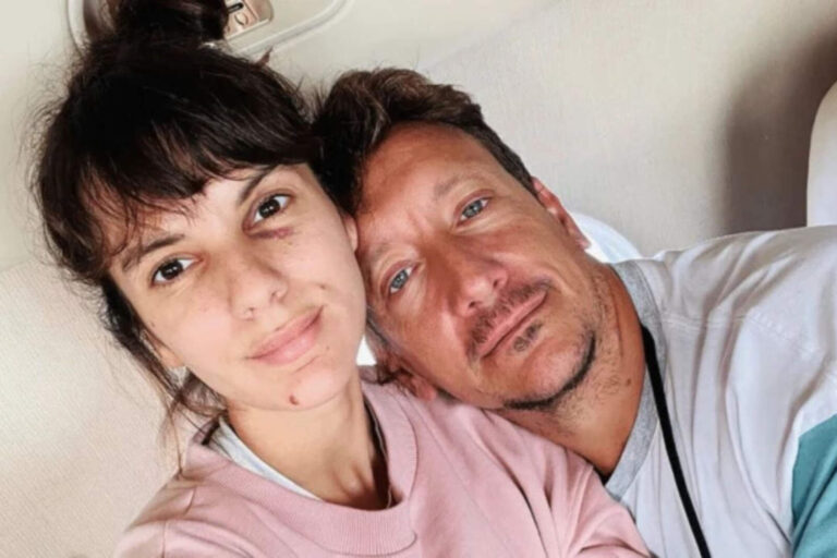Nico Vázquez habló sobre la posibilidad de recomponer su relación con Gime Accardi